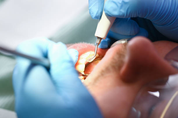 Best Mobile Emergency Dentist in Valley Forge, TN