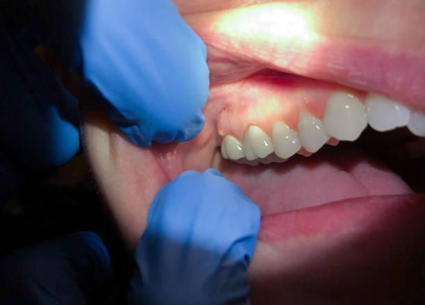 Best Urgent Dental Care for Toothache in Valley Forge, TN