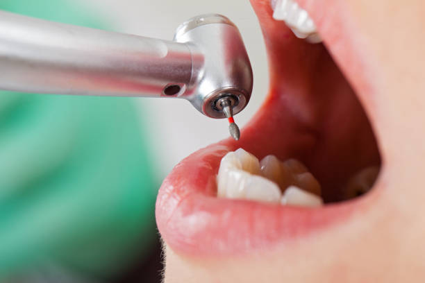 Best Emergency Dental Care for Abscessed Tooth in Valley Forge, TN